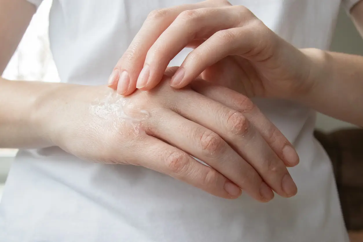Nahaufnahme von zwei Händen, die Handcreme auftragen 